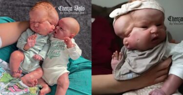 Newborn With 2 Faces